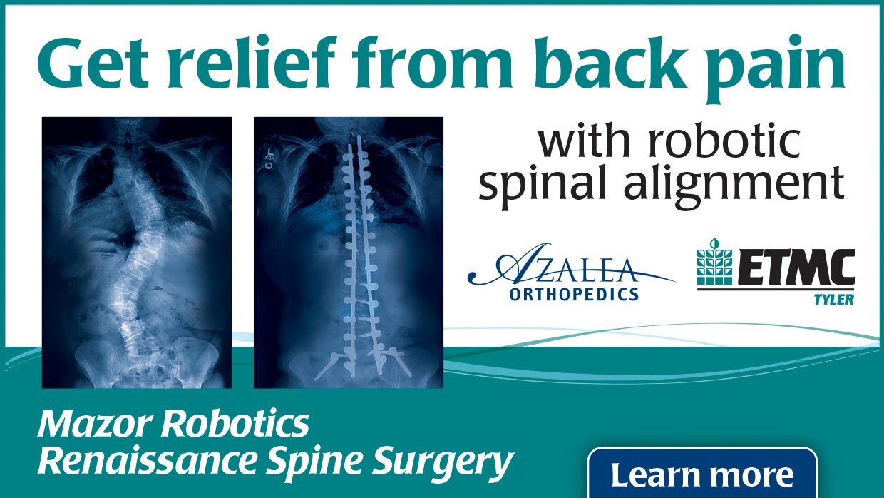 Adult scoliosis surgery with the Mazor Robotics Renaissance® Guidance System from Azalea Orthopedics & ETMC