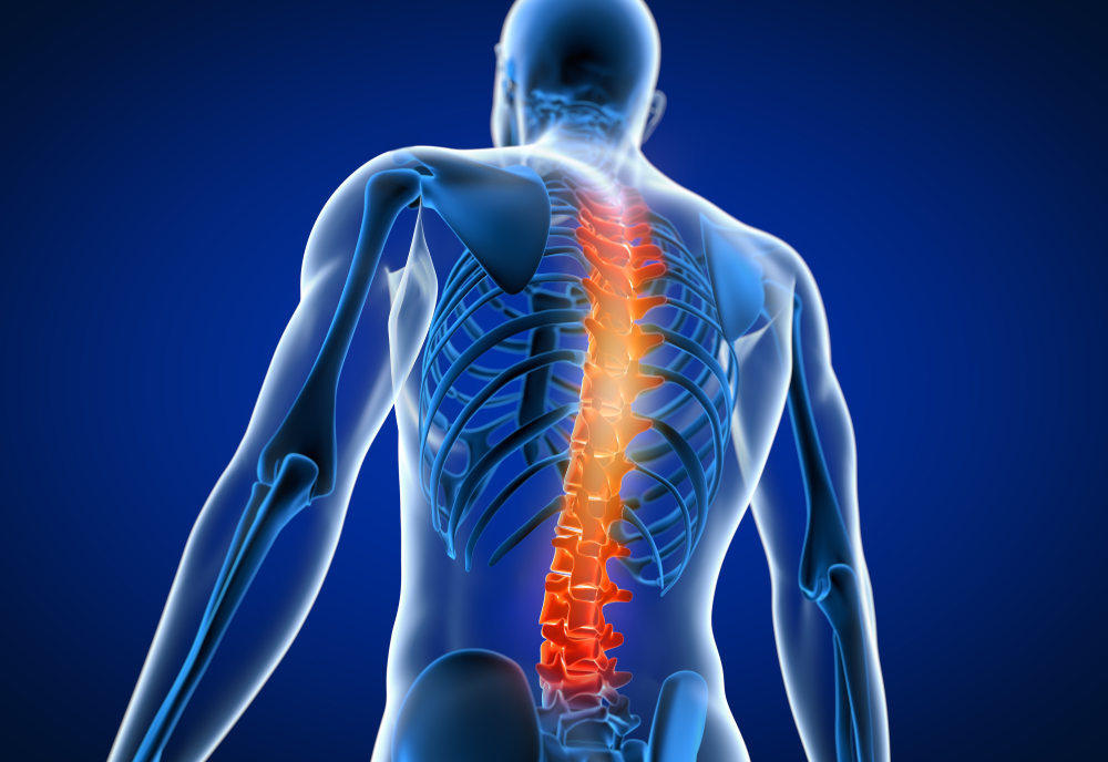 Back Surgery: Types, Recovery & Considerations
